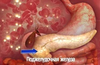 >> ПАНКРЕАТИТ