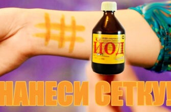 Йодовая сетка - целебные свойства простых линий