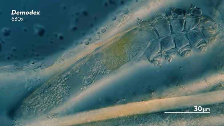 Целая армия: как выглядят клещи на теле человека под микроскопом