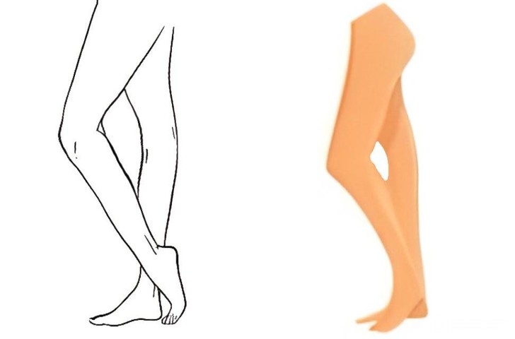 Задние колени — не норма: врач предупредил об опасном симптоме, который можно увидеть на ногах