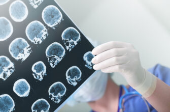 Последствия для мозга необратимы: герпес может провоцировать болезнь Альцгеймера (исследование)