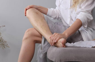 Почему вредно носить тесную обувь, объясняет ортопед Черемисова