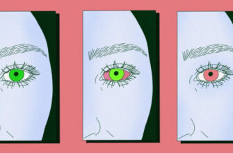 Что делать, если лопнул сосуд в глазу