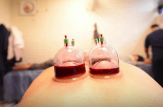 Что такое хиджама и правда ли она помогает при болезнях