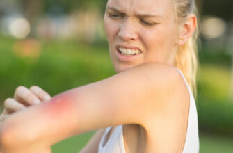 Биолог Трофимова объяснила, как безопасно вытащить клеща, даже если под рукой нет пинцета