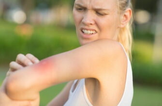 Чем снять зуд от укусов насекомых: эффективные средства после укусов комаров и мошек