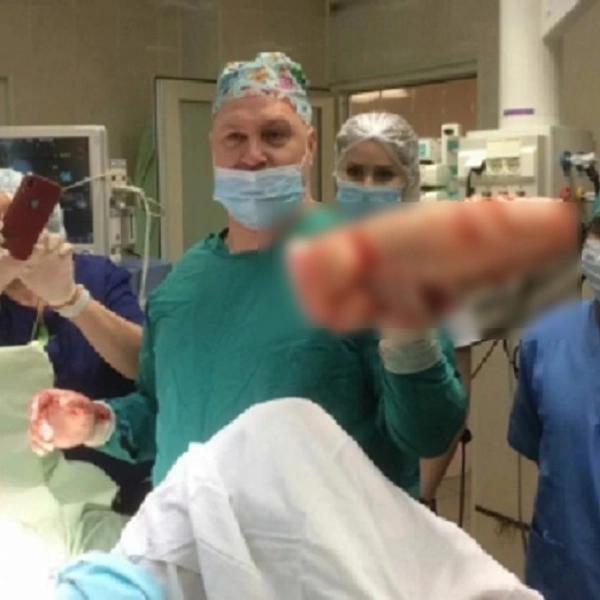 Китайские врачи удалили зубную щетку из кишечника мужчины спустя полвека