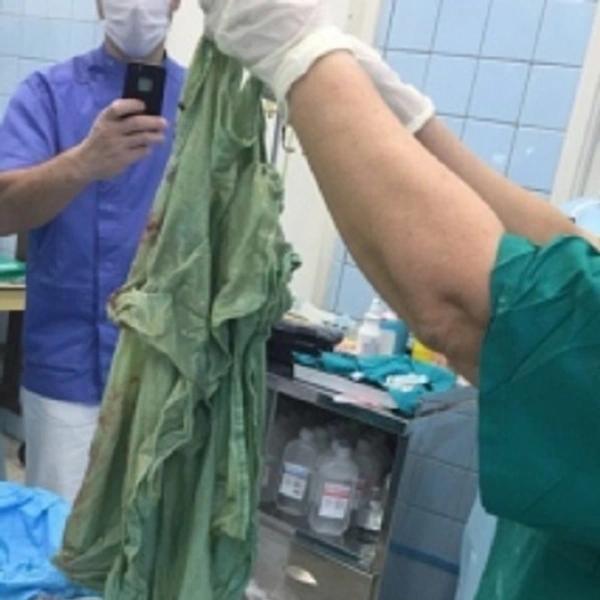 Китайские врачи удалили зубную щетку из кишечника мужчины спустя полвека
