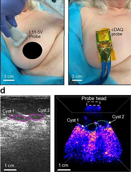 Создан аппарат, который находит опухоли в груди без ощупываний в домашних условиях