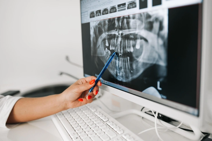 Имплантация зубов: что важно знать, если вы все еще боитесь вернуть улыбку Имплантация зубов: что важно знать, если вы все еще боитесь вернуть улыбку